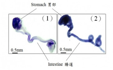 香港大學(xué)李嘉誠醫(yī)學(xué)院發(fā)現(xiàn)影響腸神經(jīng)細胞發(fā)育的新基因變異